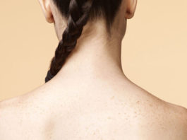 Những nguyên nhân khiến bạn bị mụn ở ngực và lưng không ngờ tới