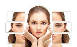 Tổng hợp các cách trị tàn nhang hiệu quả và an toàn nhất