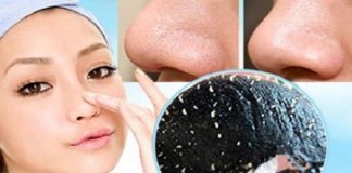 2 công thức đánh bay mụn vĩnh viễn bạn nên thử ngay