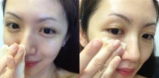 Mẹo hay trị mụn với gừng mà bạn có thể chưa biết Mẹo hay trị mụn với gừng mà bạn có thể chưa biết