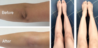 “Bí quyết” hay làm sáng da ở khuỷu tay và đầu gối