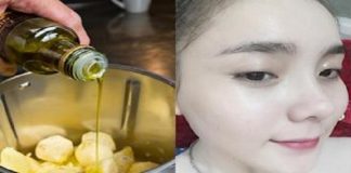 Công thức từ dầu dừa khiến nám, tàn nhang lâu năm cũng trị dứt điểm Công thức từ dầu dừa khiến nám, tàn nhang lâu năm cũng trị dứt điểm