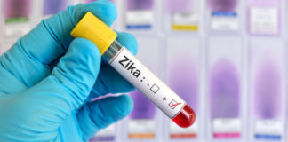Virus Zika và những điều cần biết về virus Zika khi mang thai