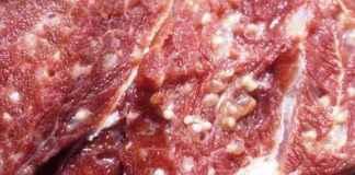 Nguyên nhân và cách phòng nhiễm bệnh sán gạo lợn