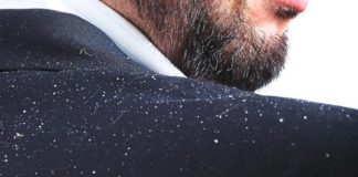 Những biện pháp điều trị gàu tại nhà một cách hiệu quả nhất Những biện pháp điều trị gàu tại nhà một cách hiệu quả nhất