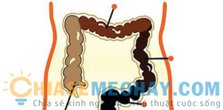 Chăm sóc sức khỏe: Ăn gì để chữa bệnh táo bón? Ăn gì để chữa bệnh táo bón